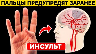 Так Китайцы По Пальцам Определяют, Что Скоро Будет Инсульт. Как Вовремя Определить Инсульт?