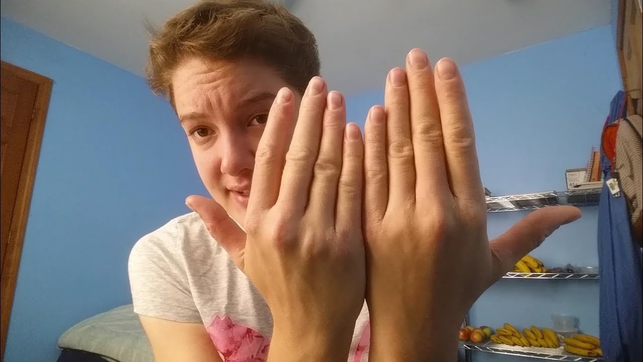 The 2 Most Important Tips to Reverse Eczema YouTube