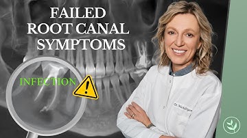 Warning Signs Your Root Canal Failed: Should You Get A Root Canal?
