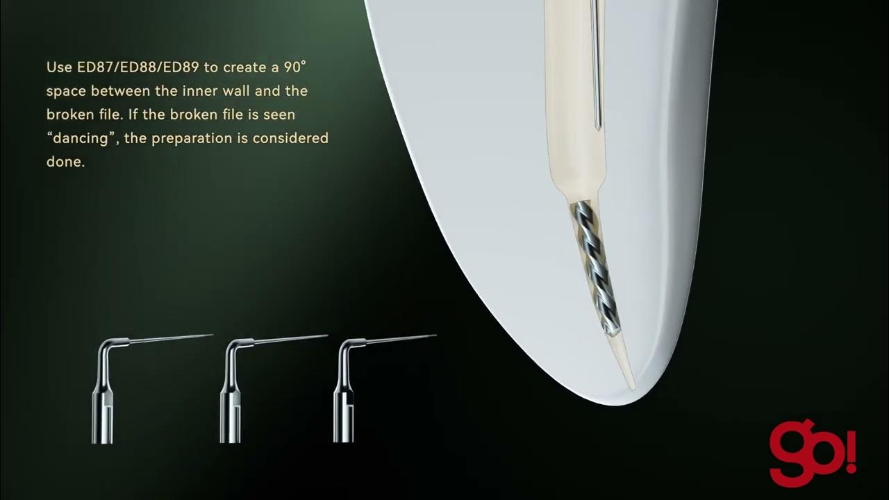 TFRK Terauchi File Removal Kit par Woodpecker DTE YouTube