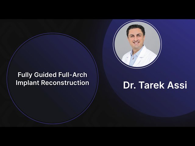 ICOI Presents | Fully Guided Full Arch Implant Reconstruction class=