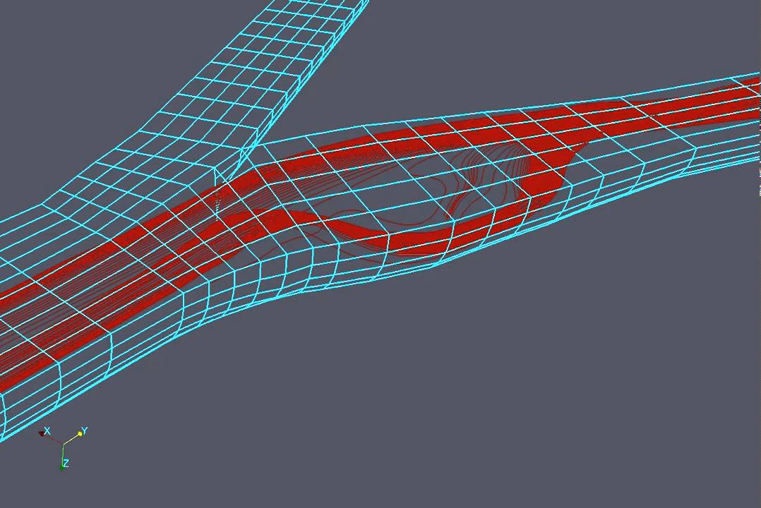 3D Carotid artery bifurcation - YouTube