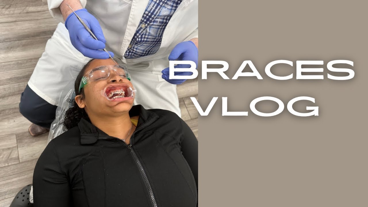 VLOG 24 hours with braces YouTube