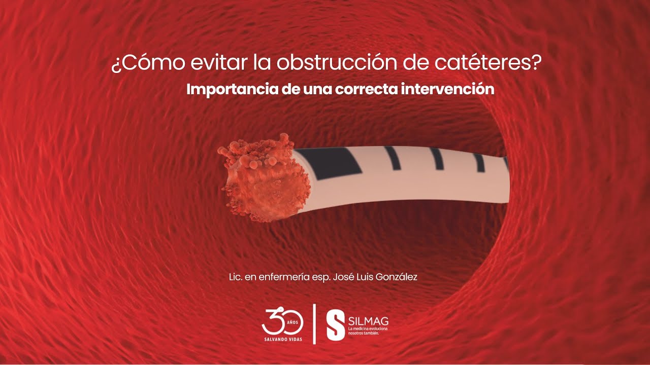 ¿Cómo evitar la obstrucción de catéteres? Importancia de una correcta