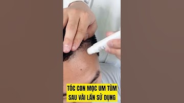 Tinh chất mọc tóc, chữa hói từ NHÂN SÂM HÀN QUỐC