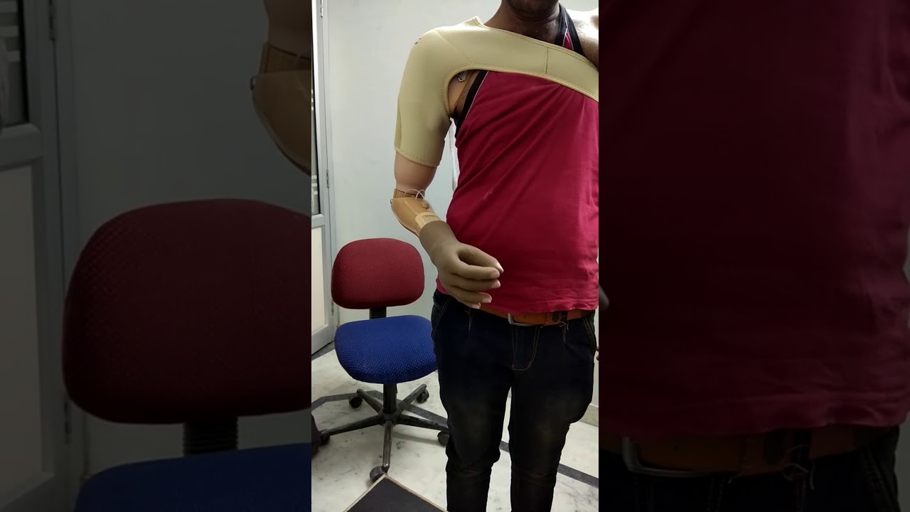 Above Elbow Myo Electric Prosthesis by Foot Care Jaipur (Artificial