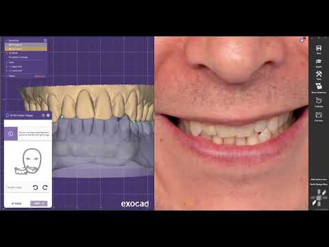 كيف تبدأ رحلتك في التصميم الرقمي للأسنان كورس الإكسوكاد للمبتدئين