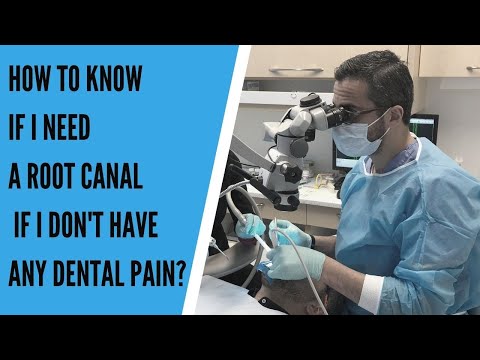 How To know If I Need A Root Canal If I Don't Have Any Dental Pain?