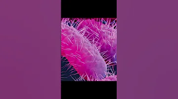 CDC Issues Warning Over An Increase Of Drug Resistant Shigella Bacteria 
