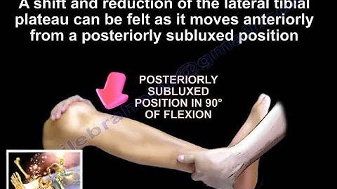 Reverse Pivot Shift  - Everything You Need To Know - Dr. Nabil Ebraheim