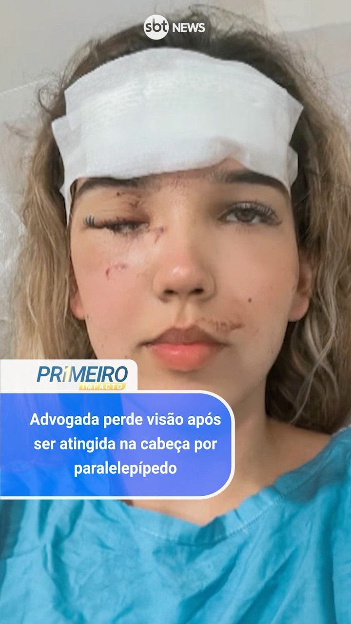 Advogada perde visão após ser atingida na cabeça por paralelepípedo