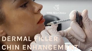 Dermal Filler Chin Enhancement | Dr Rupert Critchley VIVA Skin Clinics