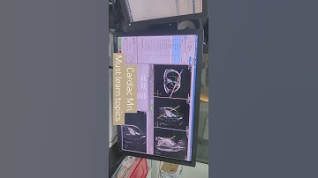 #3t #mri #diagnosticradiology #cardic #anatomy #heart #must #learn #topic @avnishradiology
