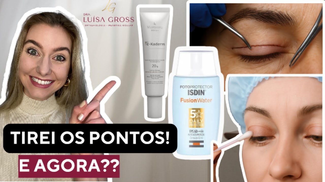 Cuidados após a Retirada dos Pontos da Blefaroplastia