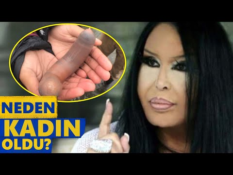 Bülent Ersoy Neden