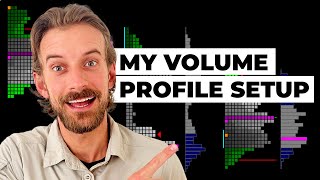 Volume Profile Trading Strategy: Sierra Charts Setup & How I Trade