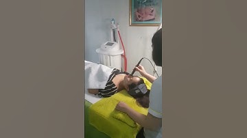 Quy trình căng da trẻ hóa xóa nhăn bằng cn cao độc quyền tại viện Shapeline