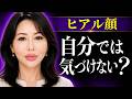 【話題】"ヒアル顔おばさん"が生まれる理由とは？整形やりすぎの境界線