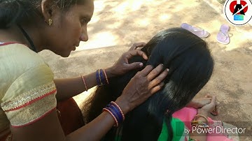 OMG! HUNDREDS OF NITPICKING/LICEPICKING | PLENTY OF TINY EGGS WITH REAL SOUNDS