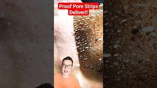 PROOF PORE STRIPS WORK - Phenomenal Pore Strip Removal #shorts