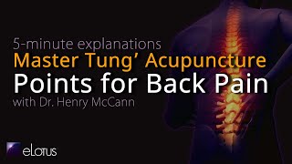 5-minute explanation: Tung's Acupuncture for Lumbar Pain with Dr. Henry McCann