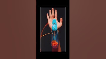 what an ARACNA looks like