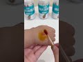 Quick and Easy Wound Care Portable Iodine Swabs to the Rescue!