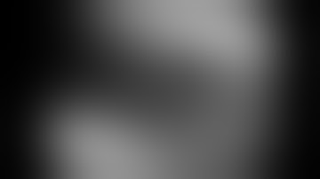 InstaFix™ Shape Memory Fixation System for LisFranc Repair with Samuel E  Ford, MD