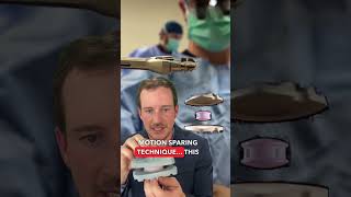 Adjacent Segment Disease & Disc Replacement Guide
