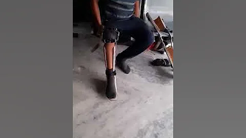 Polio Leg Caliper (Kafo Brace) german components @MyCareProstheticsOrthotics