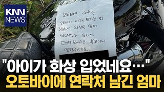 "주차된 오토바이에 화상 입었다" 쪽지 남긴 부모 / KNN