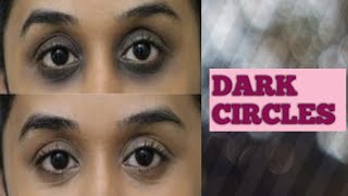 #darkcircles #DIY #kothapudi  #athome DARK CIRCLES UNDER EYES | REMOVE AT HOME | KOTHAPUDI SNEHA