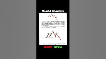 📉 Head & Shoulders Pattern Explained – Stock Market Trading Strategy! 📊🔥 #tradingadvice