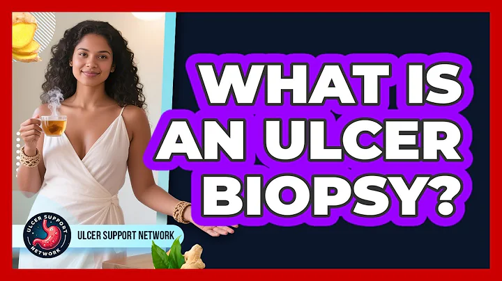 What Is An Ulcer Biopsy? - Ulcer Support Network