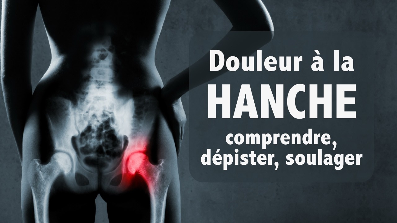 Douleur à la hanche: comprendre, dépister, soulager (tout simplement)