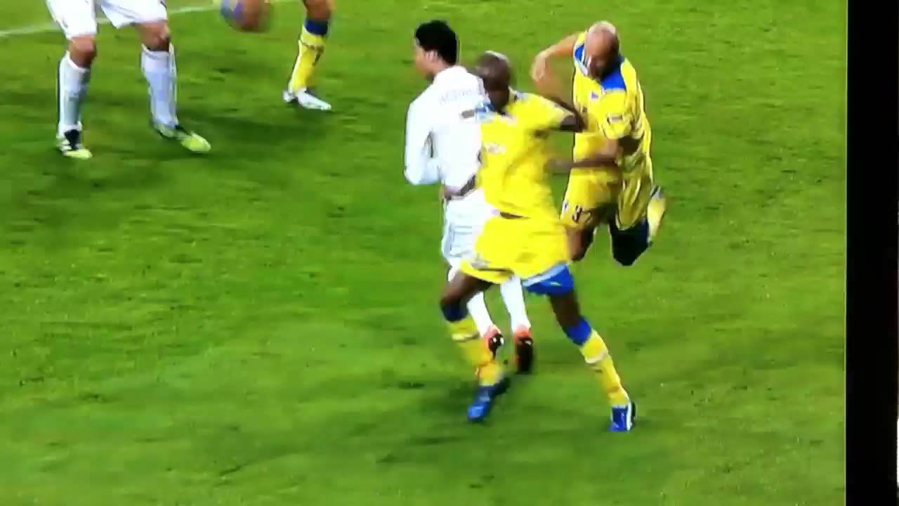 Paulo Jorge loses his teeth vs Real Madrid