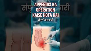 Appendix ko surgery kaise hoti hai| appendix operation. #anatomy #shorts