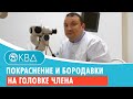 💣 Покраснение и бородавки на головке члена. Клинический случай №938