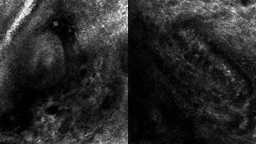 Adherent and Rolling Leukocytes in Intact Cutaneous Microvasculature via Confocal Videomicroscopy