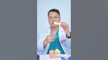 Cầu răng sứ bị hở thì phải làm sao ? | Bác sĩ Cường