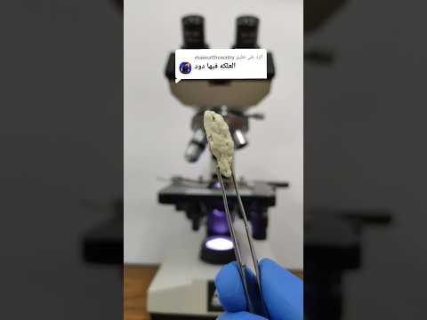 العلكة أو اللبان تحت الميكروسكوب