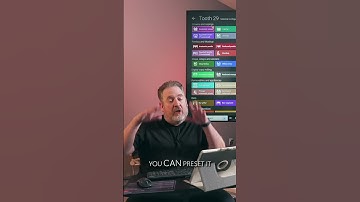 Understanding your Exocad presets! #exocad #aadentalondemand #digitaldentistry