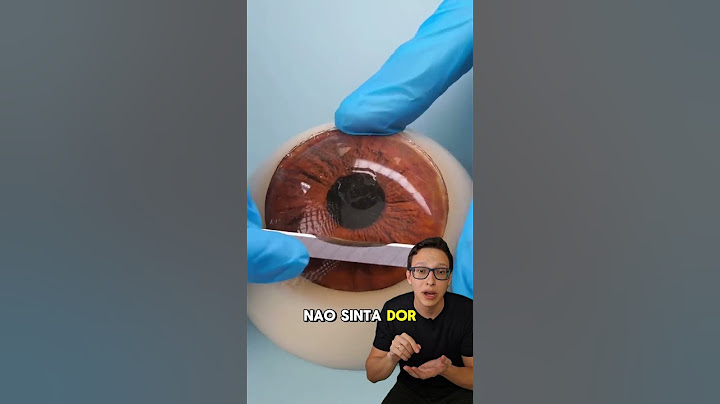 Corrigindo Miopia 👨‍⚕️👓 #medicina #medico #oftalmologia #curiosidades #curiosidademedicina #saude