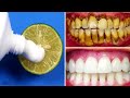 3 Dakikada Doğal Beyaz Dişlere Nasıl Sahip Olunur (2 Basit Diş Beyazlatma Yöntemi)