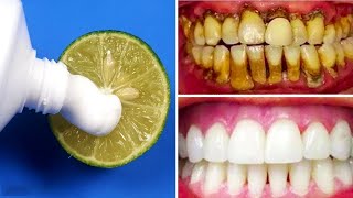 3 Dakikada Doğal Beyaz Dişlere Nasıl Sahip Olunur 2 Basit Diş Beyazlatma Yöntemi