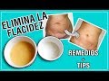 ELIMINA LA FLACIDEZ ABDOMINAL ! REMEDIOS CASEROS l Kariniwiii