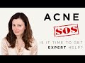 Acne: When It’s Time To Get Expert Help | Dr Sam Bunting