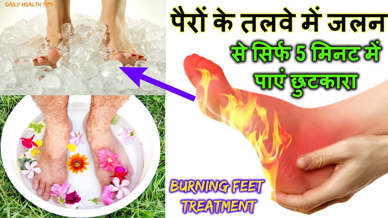 5 मिनट में पाएं छुटकारा पैरों के तलवे में जलन से Burning sensations