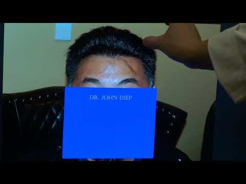 Hair Loss Treatment