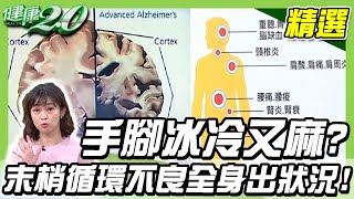 手腳冰冷又麻活化你的末梢血液循環專家激推這樣吃這樣動【健康2.0精選】